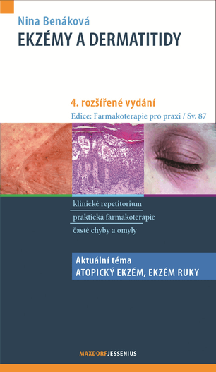 Ekzémy a dermatitidy