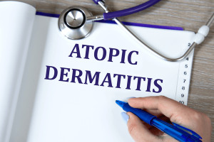 Světový den atopické dermatitidy: Jak čelit rostoucí prevalenci a komplexním fenotypům v dermatologické praxi?