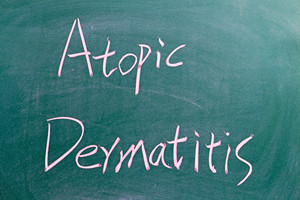 Účinnost dupilumabu po dobu až čtyř let v otevřené studii u dospělých se středně těžkou až těžkou atopickou dermatitidou