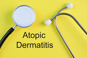 Komorbidity atopické dermatitidy – co říkají důkazy?